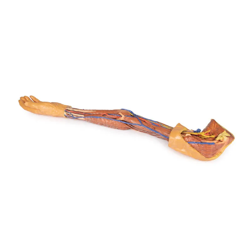 3D Printed Upper Limb Replica