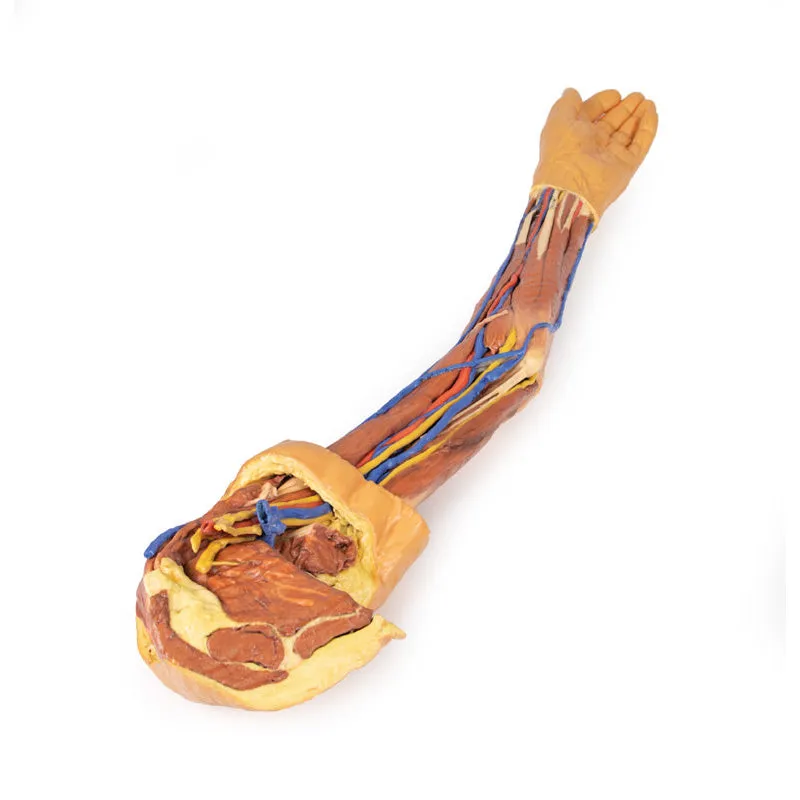 3D Printed Upper Limb Replica
